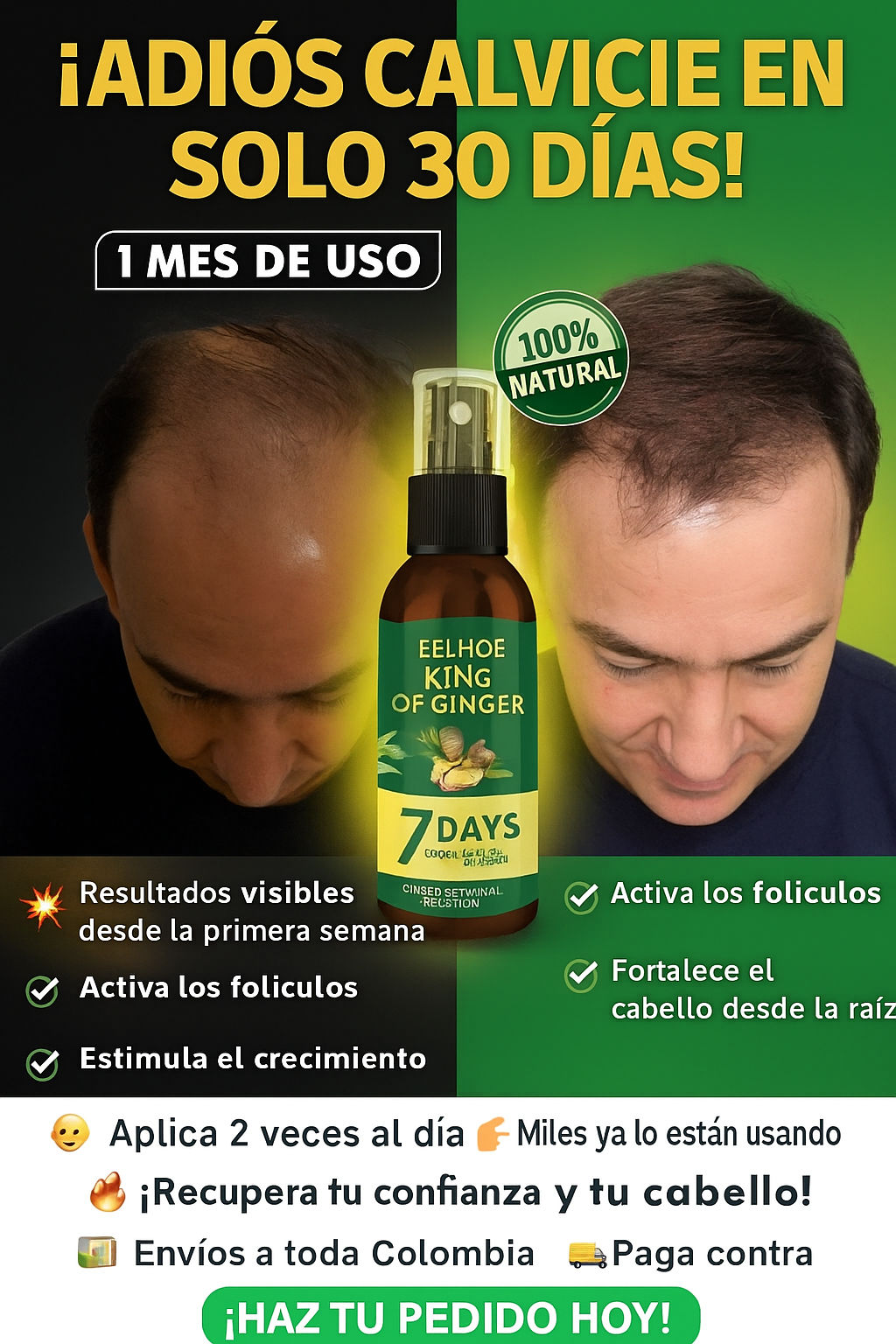🚨 Solución rápida contra la calvicie – ¡Resultados en 1 semana!